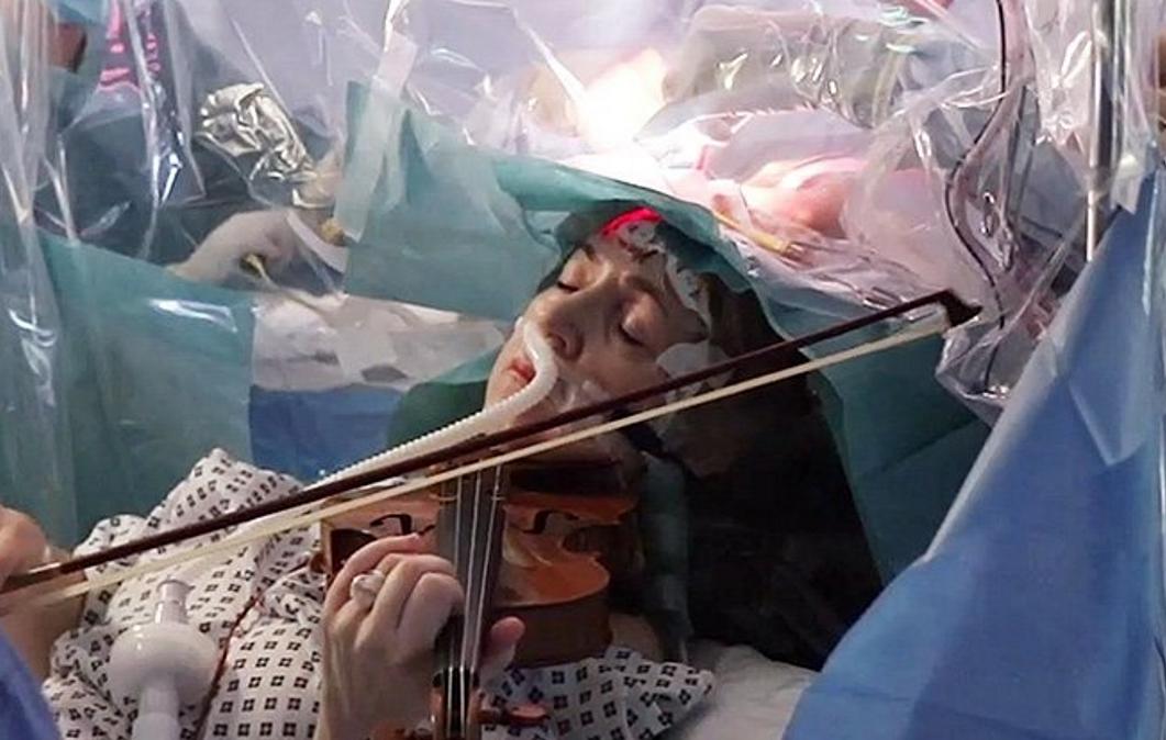 Mulher toca violino durante cirurgia no cérebro